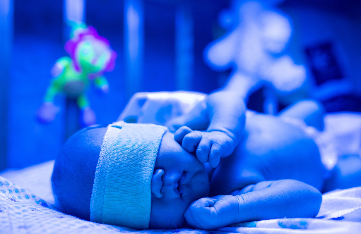 צהבת אצל תינוקות לאחר לידה – כל מה שחשוב לדעת